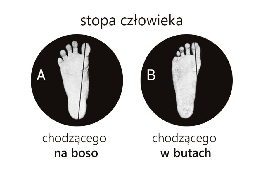 Anatomia stopy człowieka chodzącego na boso i tego, który chodził w butach