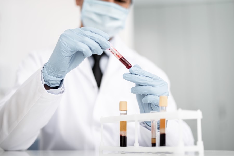 Diagnosta trzyma w rękach różne próbki krwi do badań.