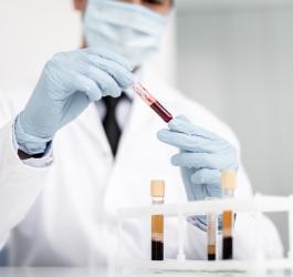 Diagnosta trzyma w rękach różne próbki krwi do badań.