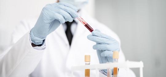 Diagnosta trzyma w rękach różne próbki krwi do badań.