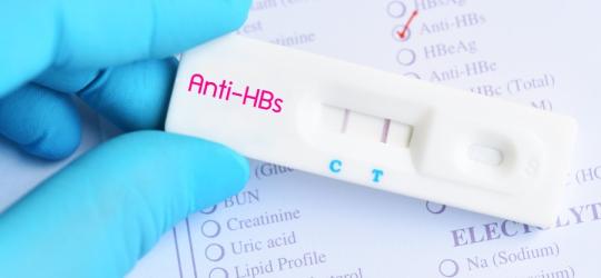 Diagnosta trzyma w dłoni test na HBs antygen.