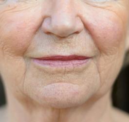 Afazja - utrata zdolności mówienia