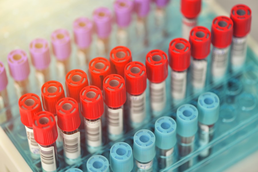 Próbki krwi przeznaczone do badań diagnostycznych.