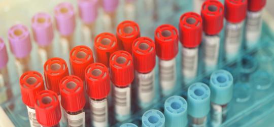 Próbki krwi przeznaczone do badań diagnostycznych.
