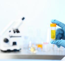 Dłoń diagnosty w rękawiczce, trzyma próbkę moczu. W tle mikroskop i sprzęt laboratoryjny.