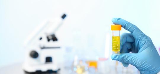 Dłoń diagnosty w rękawiczce, trzyma próbkę moczu. W tle mikroskop i sprzęt laboratoryjny.
