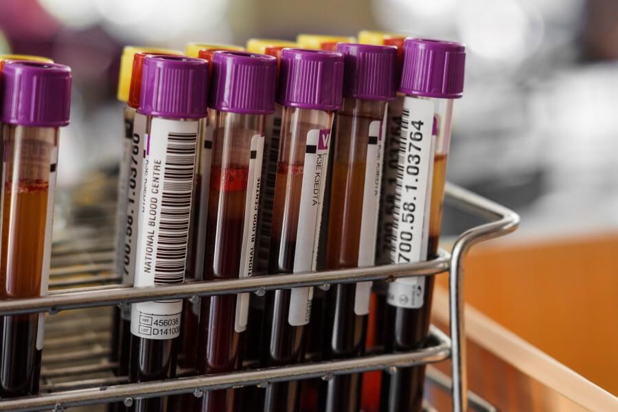 Próbki krwi przygotowanie do pomiaru stężenia androstendionu.