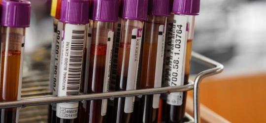 Próbki krwi przygotowanie do pomiaru stężenia androstendionu.