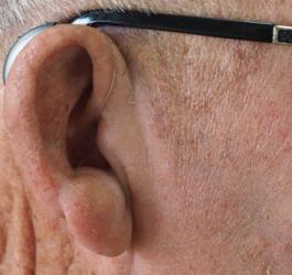 Mężczyzna ma założony aparat słuchowy.