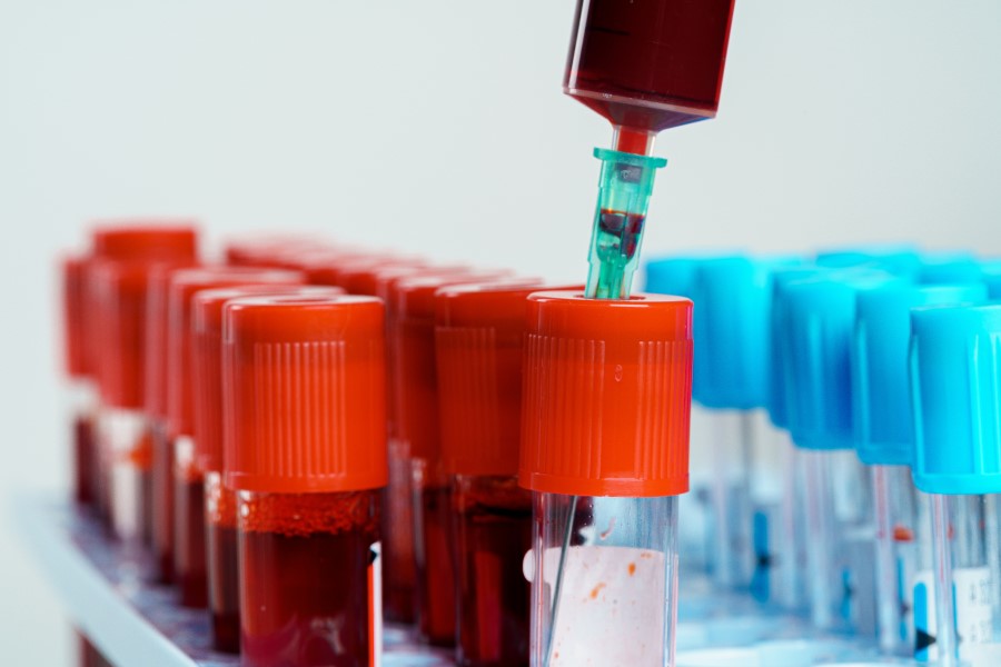 Próbki krwi przeznaczone do badania poziomu apolipoproteiny B.