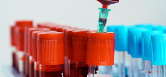 Próbki krwi przeznaczone do badania poziomu apolipoproteiny B.