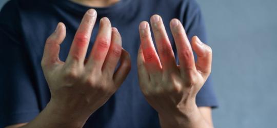 Mężczyzna zmaga się ze stanem zapalnym stawów, typowym przy artretyzmie.