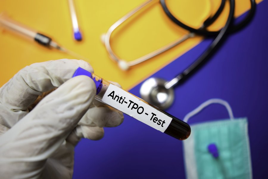 Badanie anty-TPO