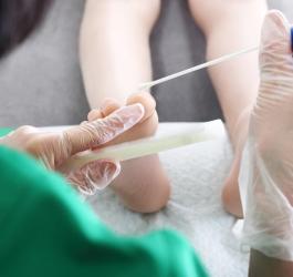 Lekarz pobiera od pacjenta próbkę do badania mykologicznego.