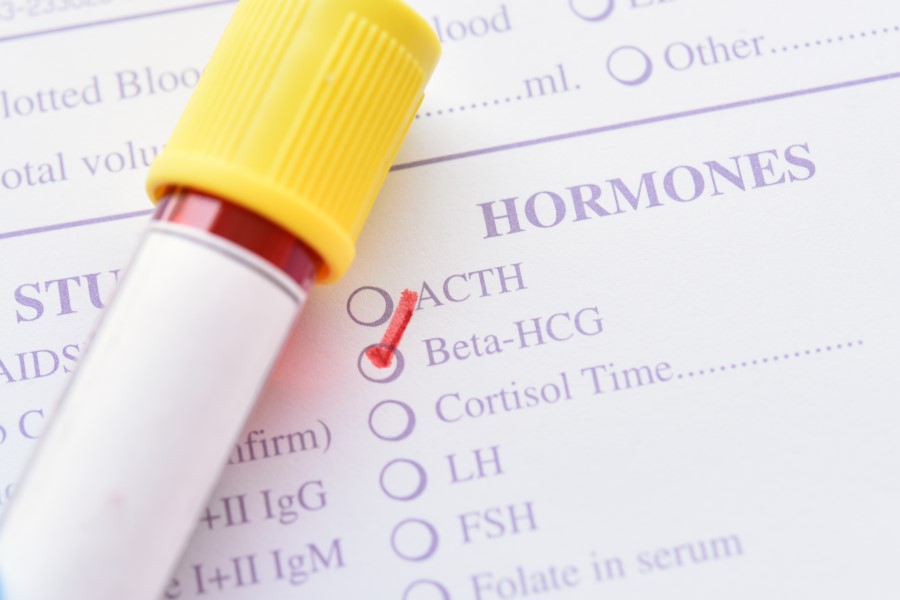 Próbka krwi przeznaczona do oznaczenia stężenia hormonu beta hCG.