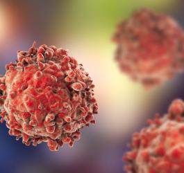 Białaczka - jak rozpoznać i jak leczyć białaczkę?