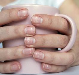 Kobieta trzyma w dłoniach kubek, ma liczne białe plamy na paznokciach.