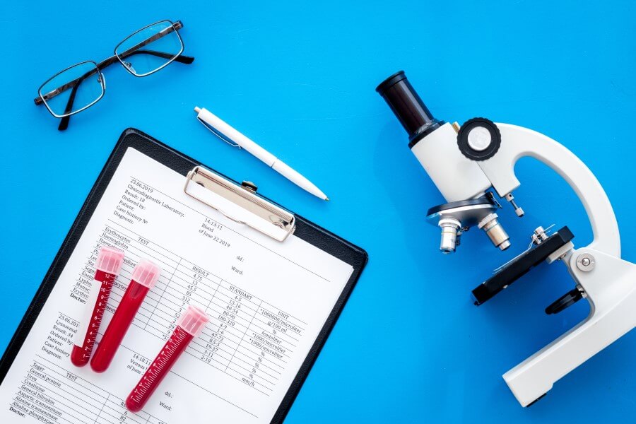 Mikroskop, okulary, kwestionariusz i próbki krwi w fiolkach na niebieskim tle.