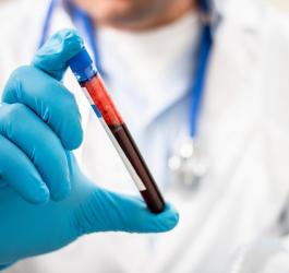 Diagnosta trzymający fiolkę z krwią przeznaczoną do badania bilirubiny bezpośredniej.