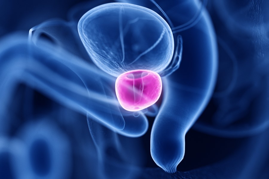Grafika 3D przedstawiająca organy wewnętrzne, z wyróżnieniem prostaty.