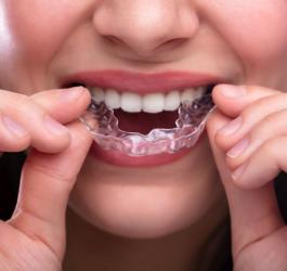 Bruksizm - przyczyny, objawy, leczenie