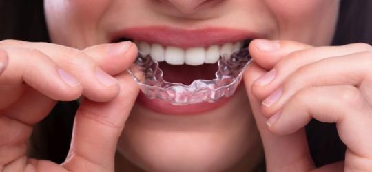 Bruksizm - przyczyny, objawy, leczenie