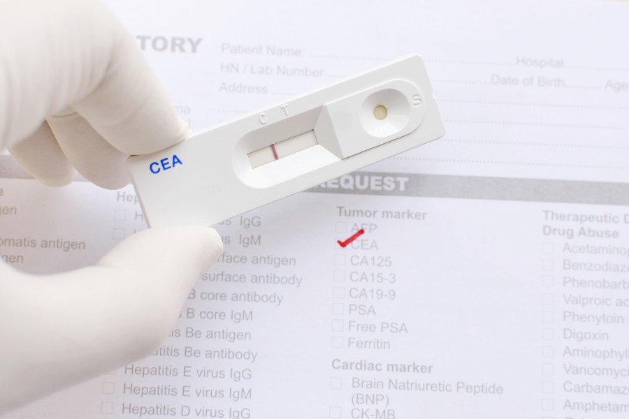 CEA - badanie markerów nowotworowych we krwi