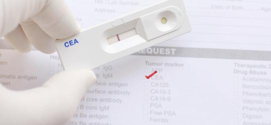 CEA - badanie markerów nowotworowych we krwi