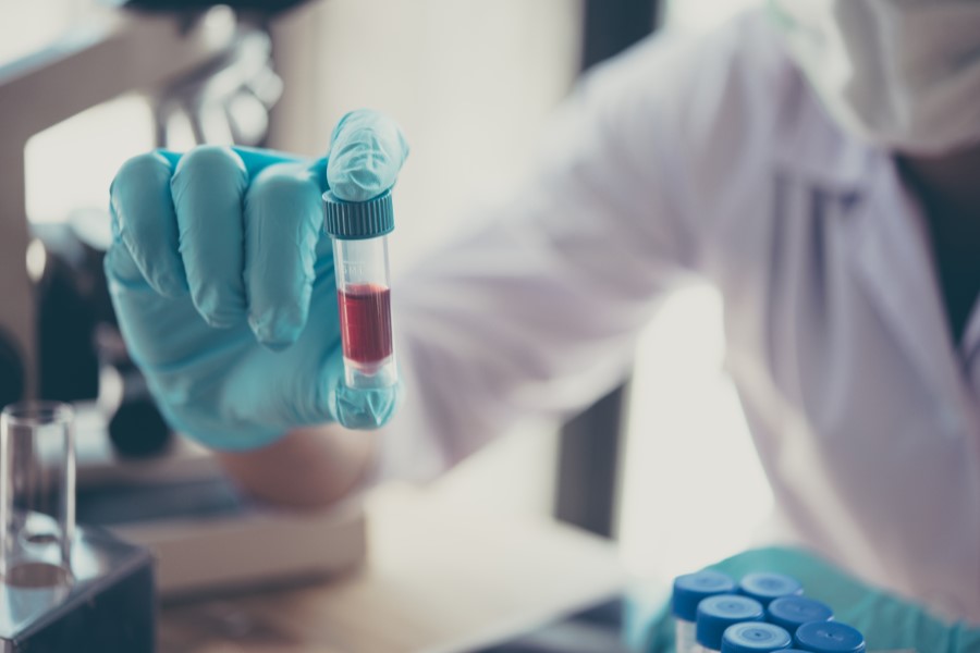 Diagnosta trzyma w ręce próbkę krwi do badania poziomu ceruloplazminy.