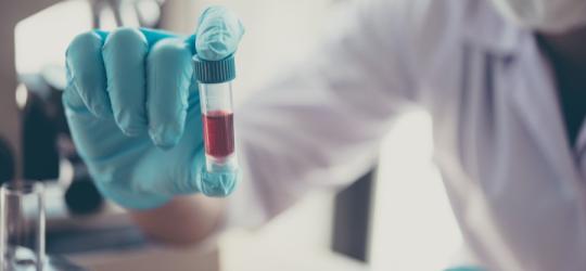 Diagnosta trzyma w ręce próbkę krwi do badania poziomu ceruloplazminy.