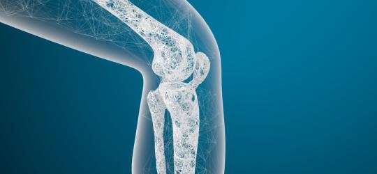 Grafika 3D przedstawiająca budowę stawu kolanowego, w tym rzepki z widoczną chondromalacją.