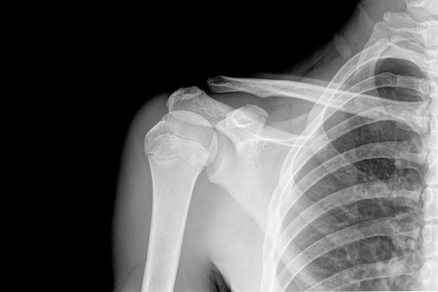 Chrzęstniak – rodzaje