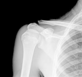 Chrzęstniak – rodzaje