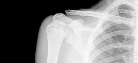 Chrzęstniak – rodzaje