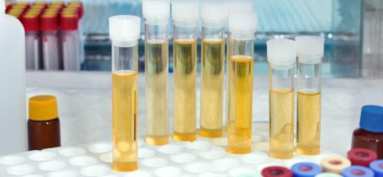 Co oznacza białko w moczu?