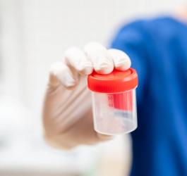 Lekarz trzyma w ręce pojemnik do badania kału.