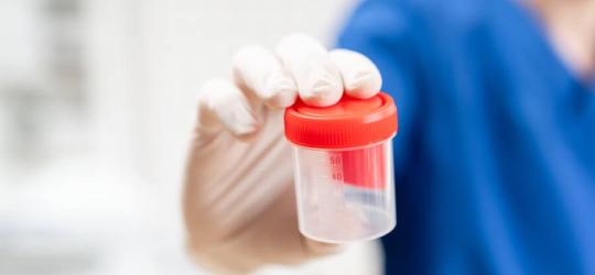 Lekarz trzyma w ręce pojemnik do badania kału.