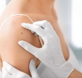 Czerniak - groźny nowotwór LekarzeBezKolejki.pl