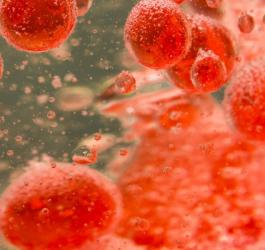 Nadmierna ilość erytrocytów w przebiegu czerwienicy prawdziwej.