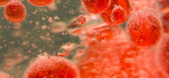 Nadmierna ilość erytrocytów w przebiegu czerwienicy prawdziwej.