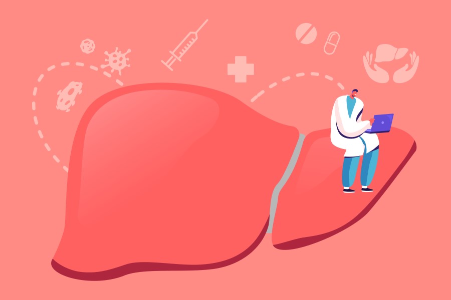 Rysunkowy model wątroby, na której siedzi diagnozujący ją lekarz.