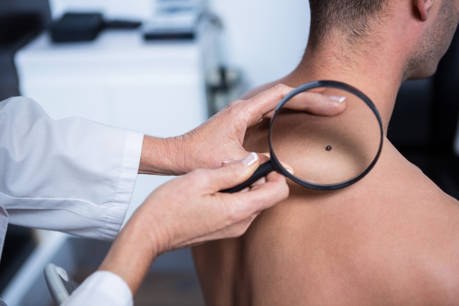 Czym się zajmuje dermatolog?