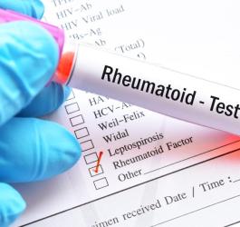 Próbka krwi przeznaczona do badania czynnika reumatoidalnego (RF).