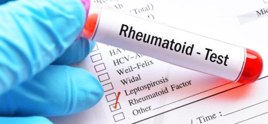 Próbka krwi przeznaczona do badania czynnika reumatoidalnego (RF).