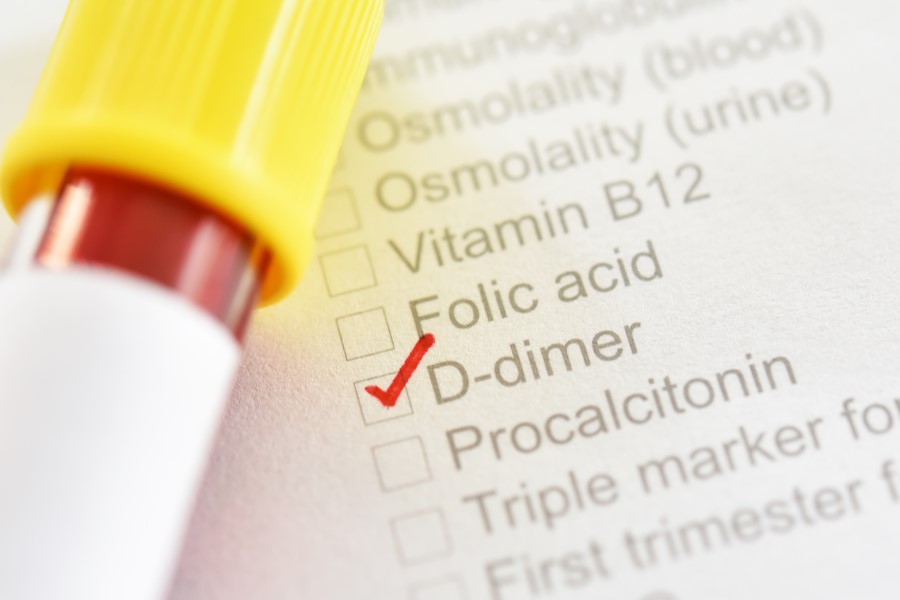 Próbka krwi leżąca na wykazie badań krwi, z zaznaczonym badaniem D-dimer.
