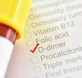 Próbka krwi leżąca na wykazie badań krwi, z zaznaczonym badaniem D-dimer.
