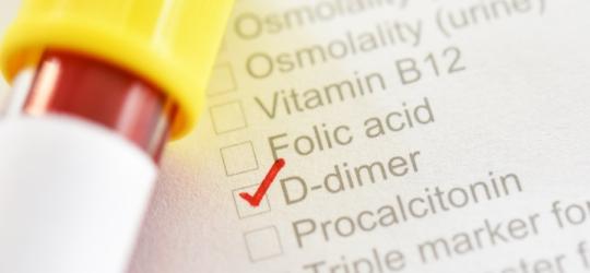 Próbka krwi leżąca na wykazie badań krwi, z zaznaczonym badaniem D-dimer.