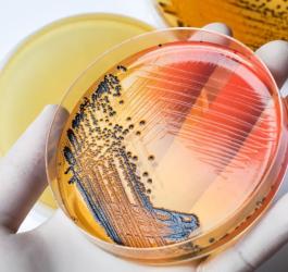 Szalka Petriego, a na niej hodowla bakterii duru brzusznego (łac. Salmonella typhi).