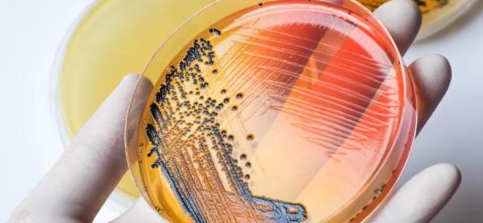 Szalka Petriego, a na niej hodowla bakterii duru brzusznego (łac. Salmonella typhi).