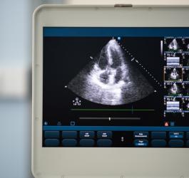 Echo serca - jak wygląda to badanie? Jak się przygotować?